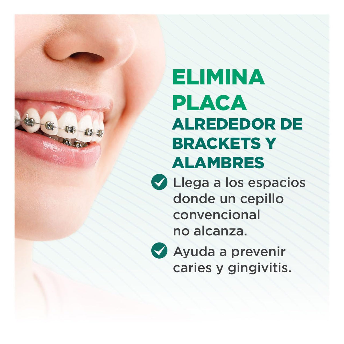 GUM - Kit de Cuidado Bucal para Ortodoncia con Cepillo Especializado en Forma de V, Cera Protectora, Cepillos Interdentales y Palillos Soft Picks con Sabor a Menta - Modelos y Colores Surtidos