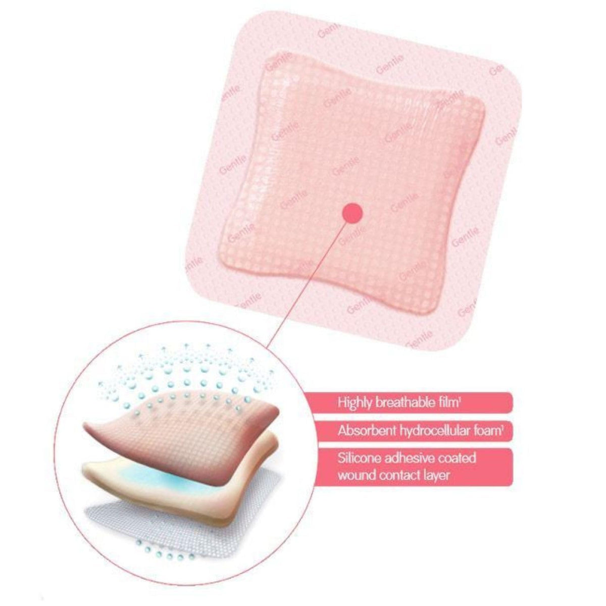 Smith+Nephew ALLEVYN Gentle Border Lite - Apósito para heridas, 2 x 2 pulgadas, caja de 10