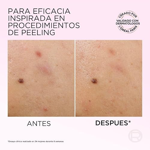 L'Oréal Paris, Glycolic Bright Peeling Exfoliante Facial Anti Manchas, Mejora la Textura y Luminosidad de la Piel, Reduce Poros Abiertos e Imperfecciones, 25 ml.