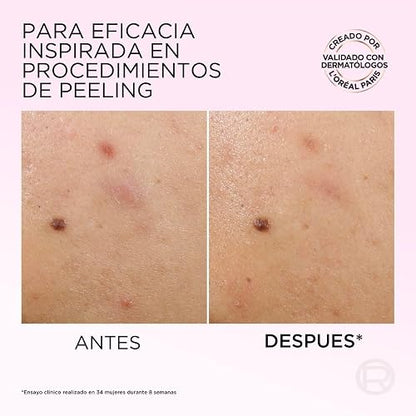 L'Oréal Paris, Glycolic Bright Peeling Exfoliante Facial Anti Manchas, Mejora la Textura y Luminosidad de la Piel, Reduce Poros Abiertos e Imperfecciones, 25 ml.
