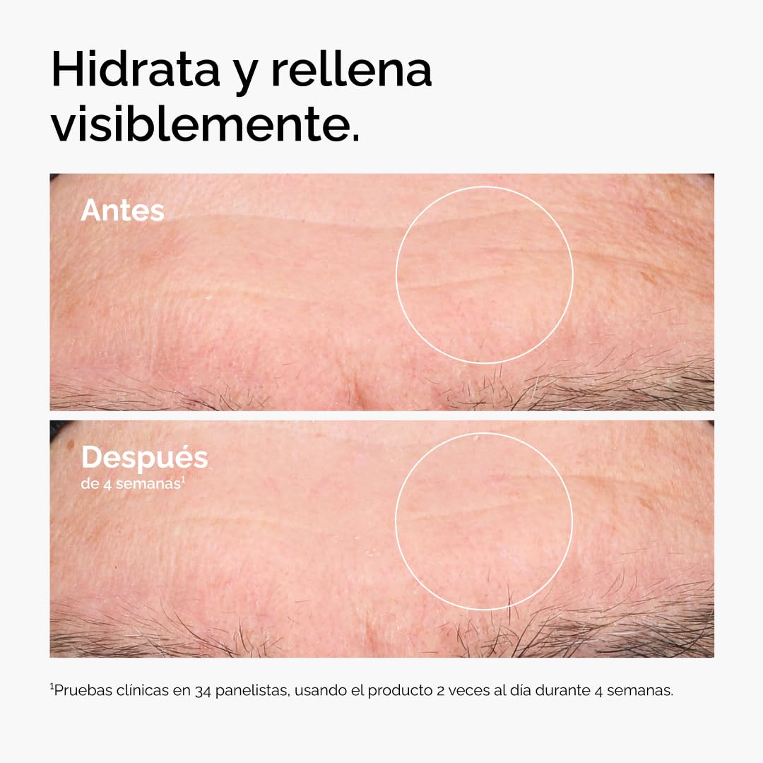 The Ordinary Hyaluronic Acid 2% + B5, Suero Hidrante con Ácido Hialurónico y Ceramidas — Suero de hidratación multiprofunda para piel más suave y con volumen, 30ml