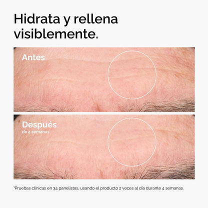 The Ordinary Hyaluronic Acid 2% + B5, Suero Hidrante con Ácido Hialurónico y Ceramidas — Suero de hidratación multiprofunda para piel más suave y con volumen, 30ml