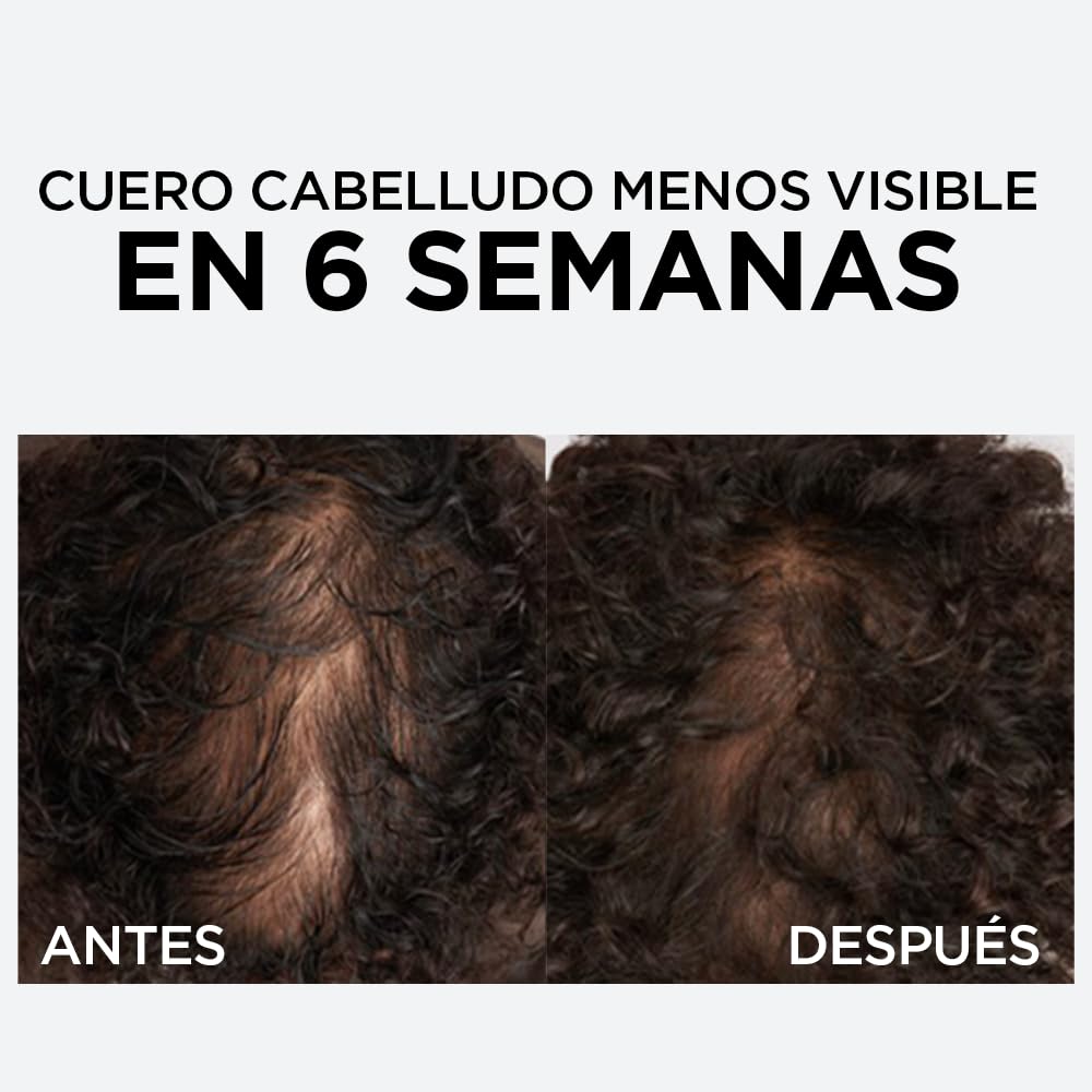 L'Oreal Paris Serum Capilar Caída Resist con Aminexil Elvive 102ml. Anti caida de cabello con tendencia a quebrarse, 10X menos cabello en el cepillo.