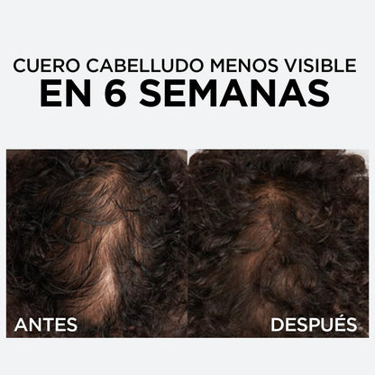 L'Oreal Paris Serum Capilar Caída Resist con Aminexil Elvive 102ml. Anti caida de cabello con tendencia a quebrarse, 10X menos cabello en el cepillo.