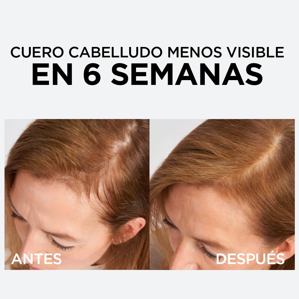 L'Oreal Paris Serum Capilar Caída Resist con Aminexil Elvive 102ml. Anti caida de cabello con tendencia a quebrarse, 10X menos cabello en el cepillo.