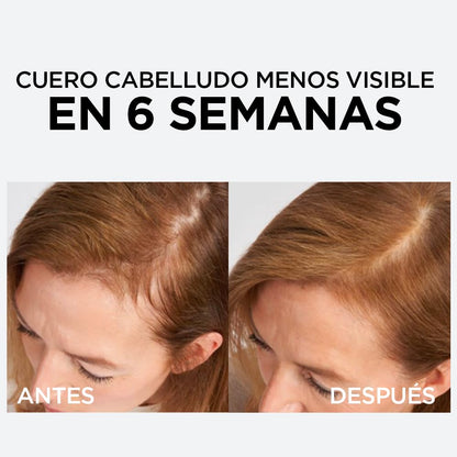 L'Oreal Paris Serum Capilar Caída Resist con Aminexil Elvive 102ml. Anti caida de cabello con tendencia a quebrarse, 10X menos cabello en el cepillo.