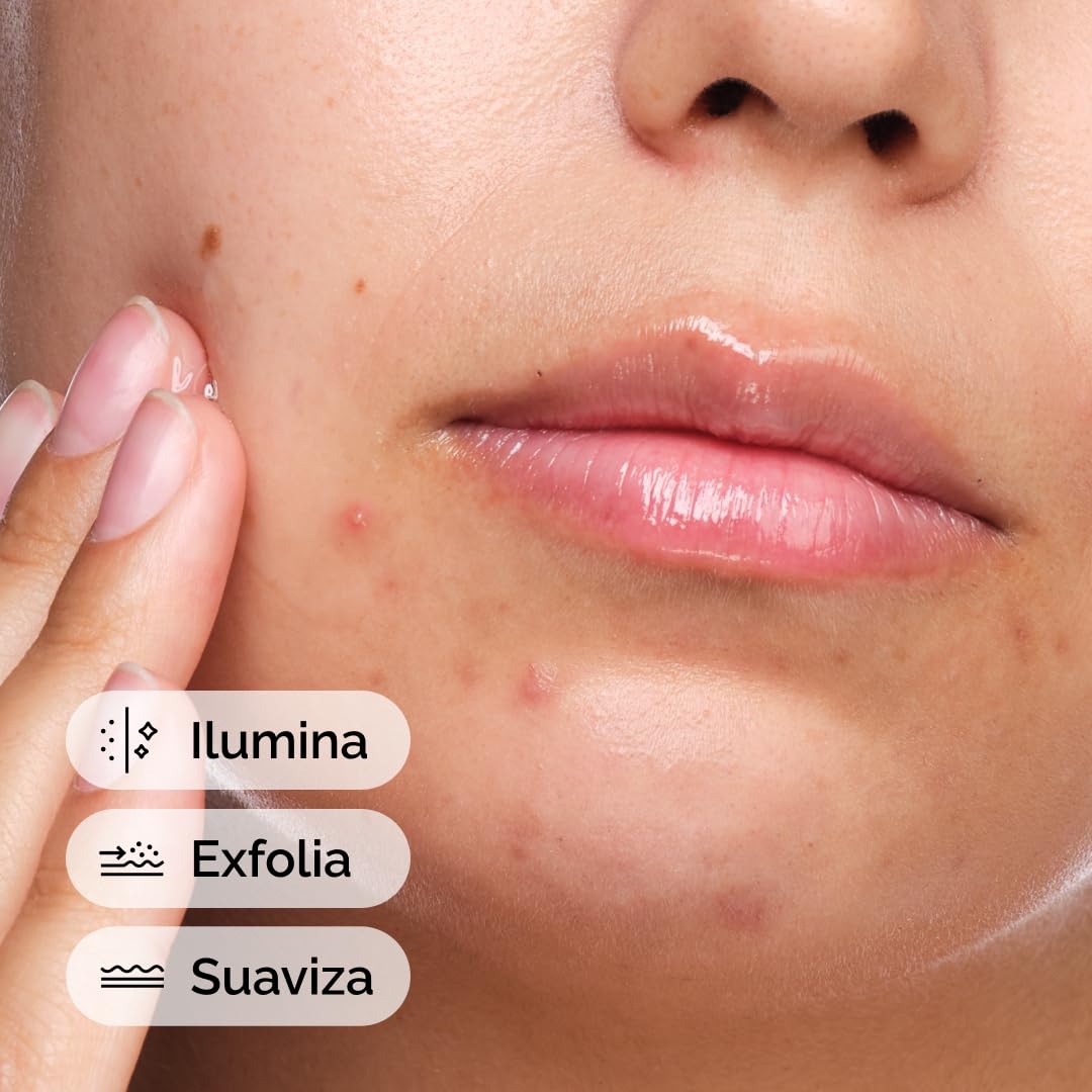 The Ordinary Salicylic Acid 2% Solution, Suero Anti-Imperfecciones con Ácido Salicílico — Suero para piel con tendencia acneica y con brotes, 30ml