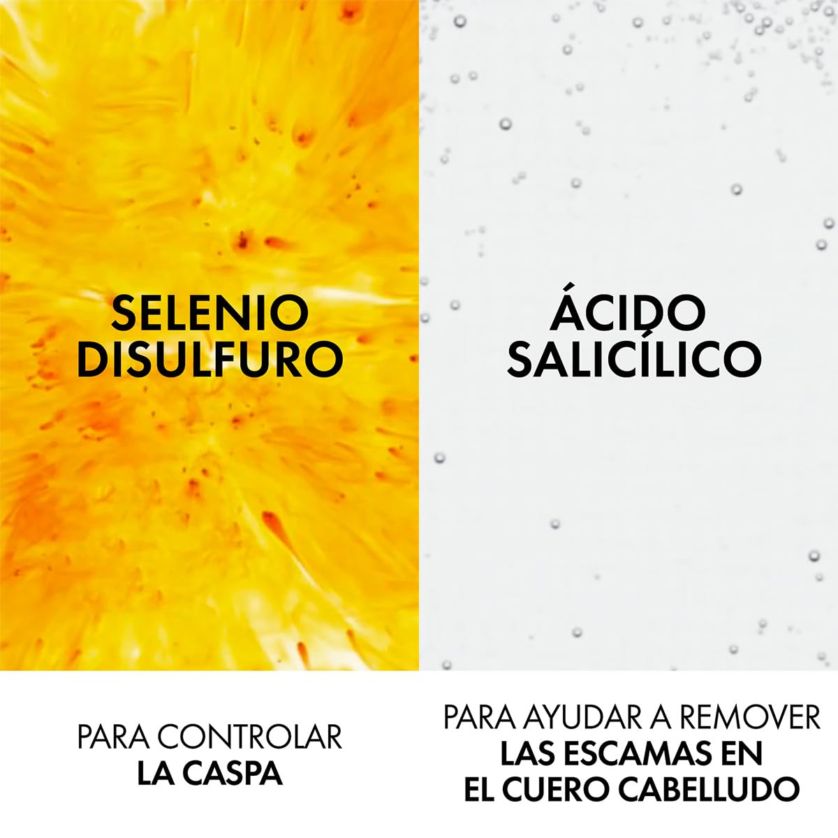 Vichy Dercos Shampoo Dermatológico Anti-Caspa Cabello Normal a Graso 200ml | Elimina 100% de Caspa Visible y su Reaparición, Reduce Comezón desde 1er Uso, con Ácido Salicílico y Selenio DS
