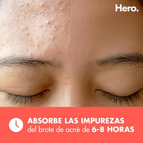 Hero Parches para Acné Mighty Patch Original, Caja con 48 Piezas para Uso de Noche. Absorben las Impurezas en 6 a 8 Horas. Fáciles de Usar y No Contienen Medicamento. Probados Dermatológicamente