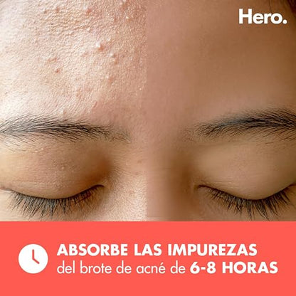 Hero Parches para Acné Mighty Patch Original, Caja con 48 Piezas para Uso de Noche. Absorben las Impurezas en 6 a 8 Horas. Fáciles de Usar y No Contienen Medicamento. Probados Dermatológicamente