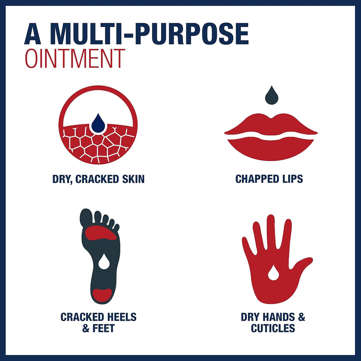 Aquaphor Healing Ointment - Protectant for Cracked Skin - Hands, Heels, Elbows, Lips - 1.75 oz. Tube (Pack of 3)