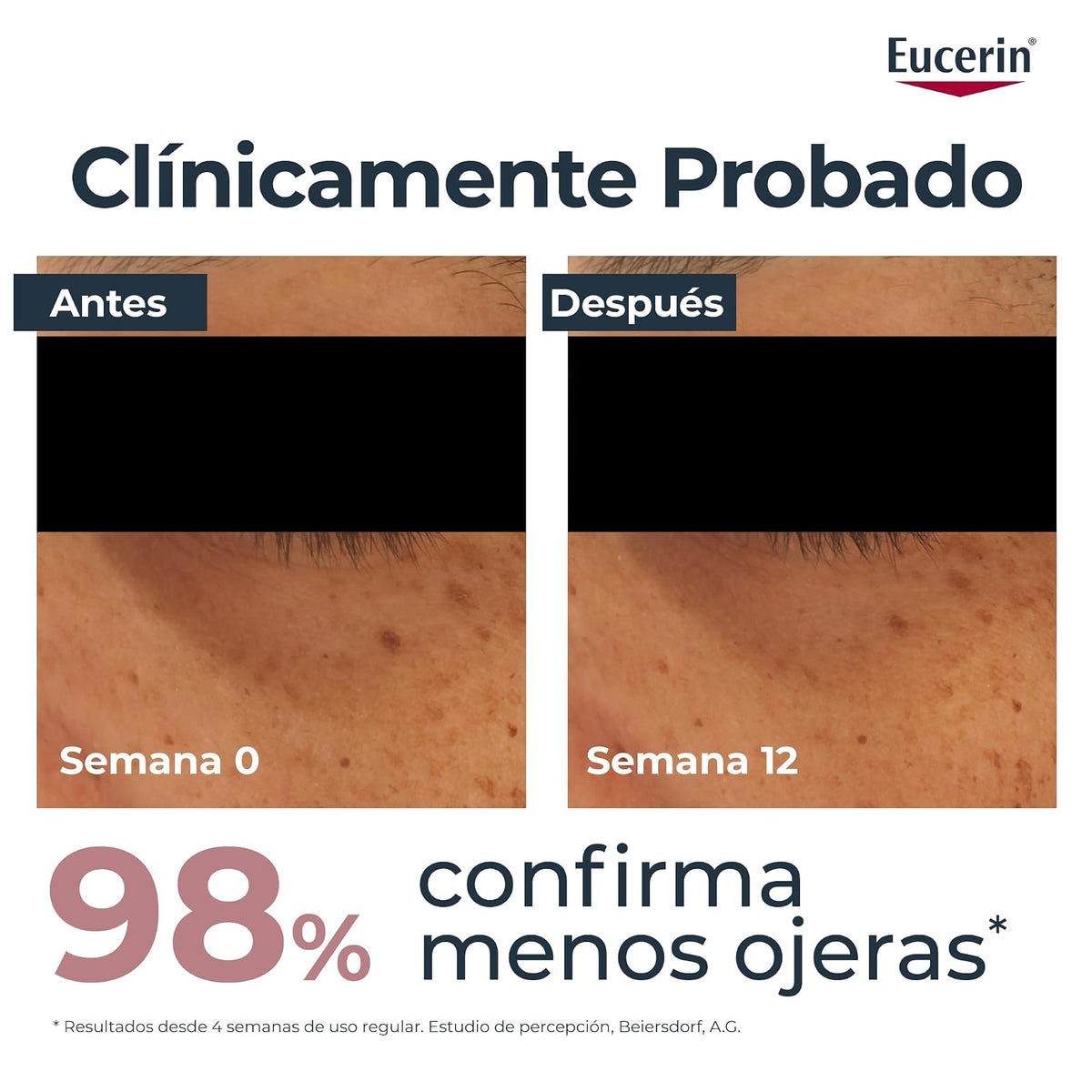 Eucerin Anti-Pigment Crema Contorno de Ojos 15ml - Suaviza las Líneas de Expresión