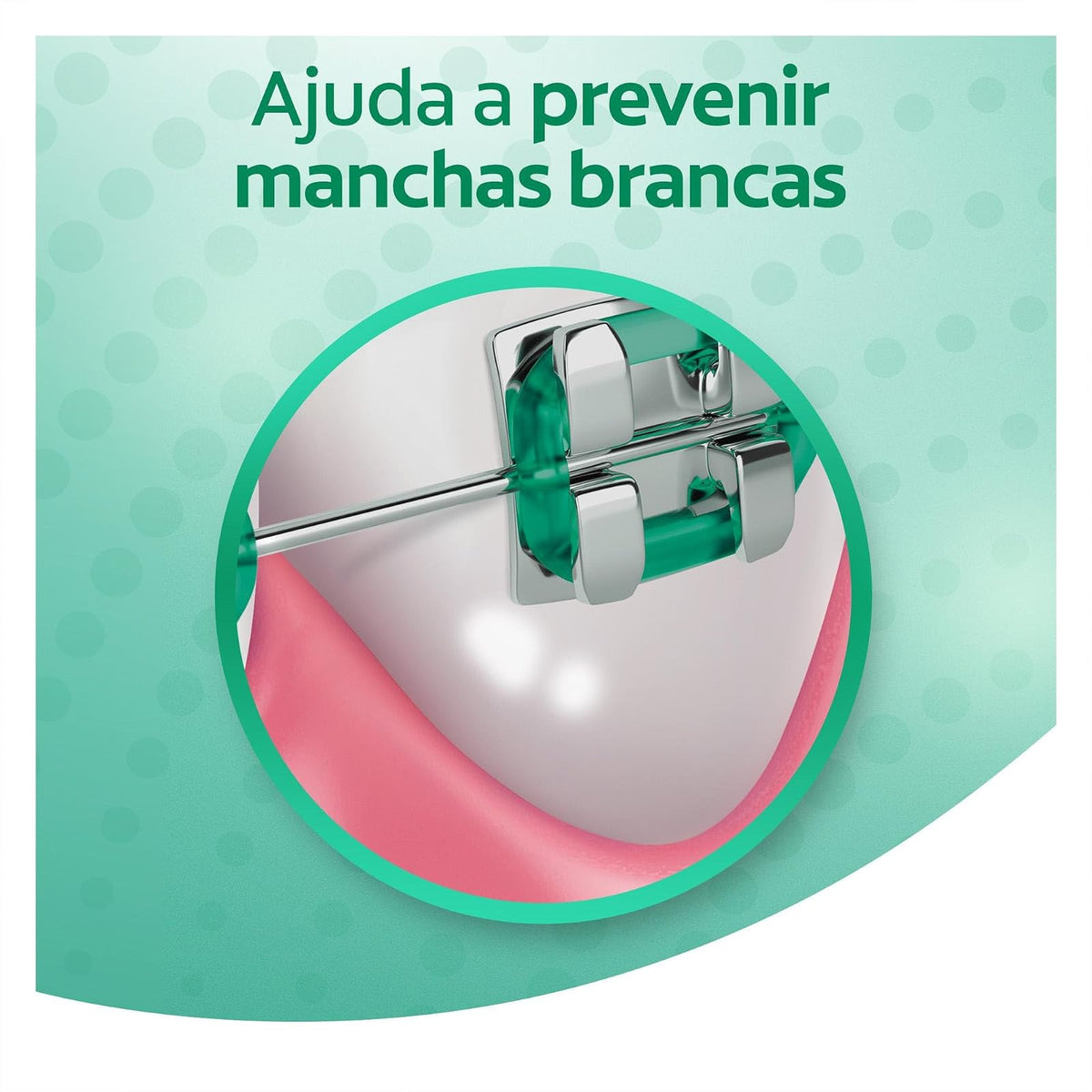 Colgate Enjuague Bucal OrthoGard Sabor a Menta Libre de Alcohol 250 ml | Brinda Protección Especializada que Ayuda a Prevenir Manchas Blancas, Descalcificación y Caries