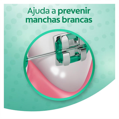 Colgate Enjuague Bucal OrthoGard Sabor a Menta Libre de Alcohol 250 ml | Brinda Protección Especializada que Ayuda a Prevenir Manchas Blancas, Descalcificación y Caries