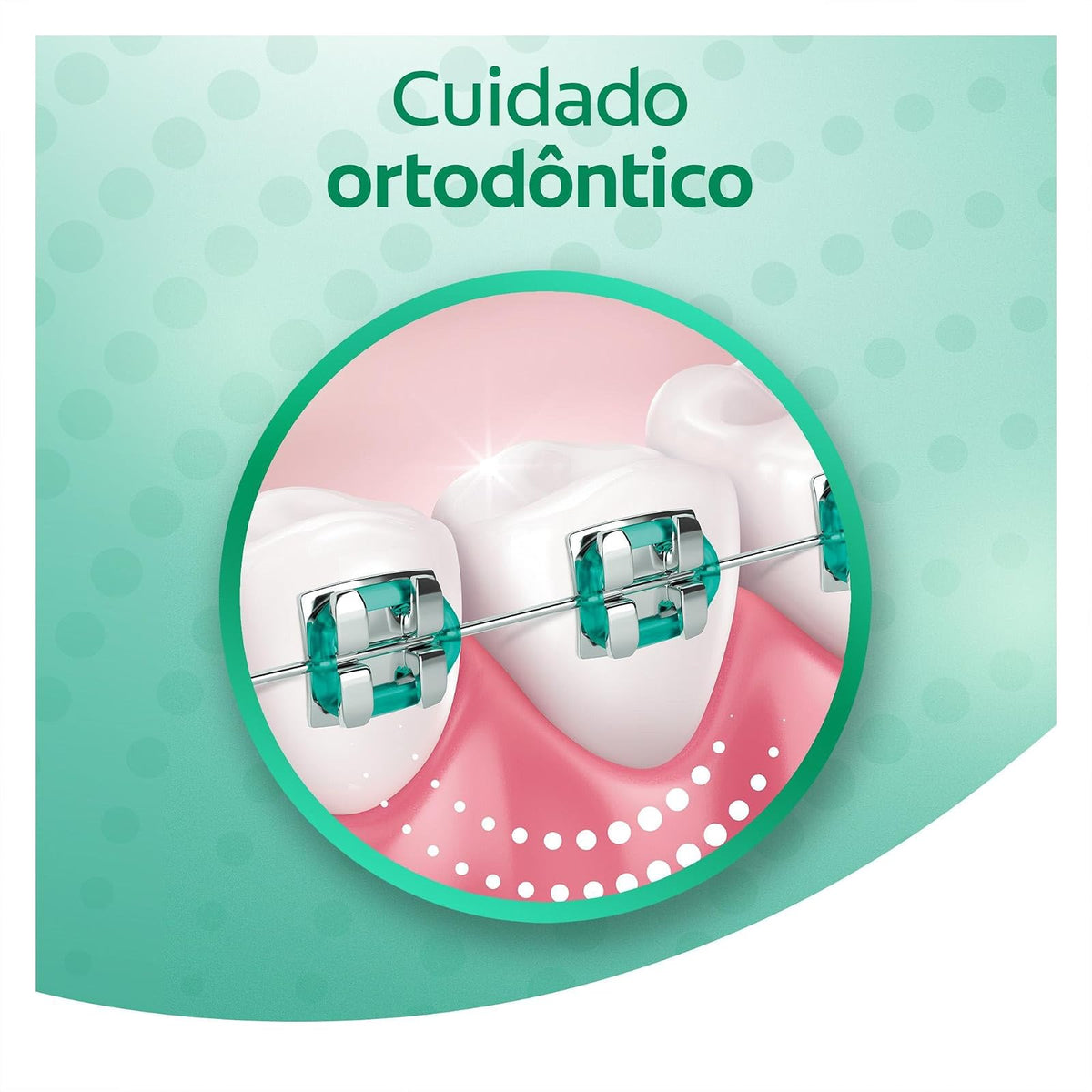 Colgate Enjuague Bucal OrthoGard Sabor a Menta Libre de Alcohol 250 ml | Brinda Protección Especializada que Ayuda a Prevenir Manchas Blancas, Descalcificación y Caries