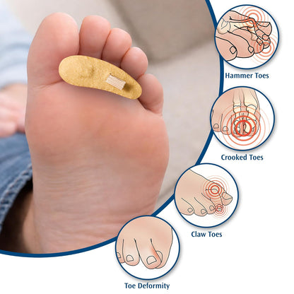 Pedifix Cojín para dedo del pie, pequeño, izquierdo