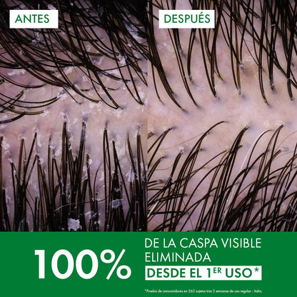 Vichy Dercos Shampoo Dermatológico Anti-Caspa Cabello Normal a Graso 200ml | Elimina 100% de Caspa Visible y su Reaparición, Reduce Comezón desde 1er Uso, con Ácido Salicílico y Selenio DS