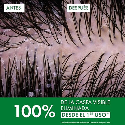 Vichy Dercos Shampoo Dermatológico Anti-Caspa Cabello Normal a Graso 390ml | Elimina 100% de Caspa Visible y su Reaparición, Reduce Comezón desde 1er Uso, con Ácido Salicílico y Selenio DS