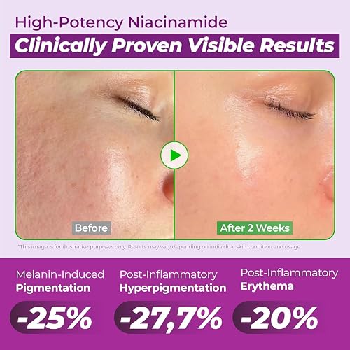 JUMISO Niacinamide 20 Serum - Korean Face Serum with Glutathione, TXA Tranexamic Acid and Centella Complex - Reduces Pigmentation, Uneven Skin Tone, Pore Care for Sensitive Skin, 1.35 fl.oz.