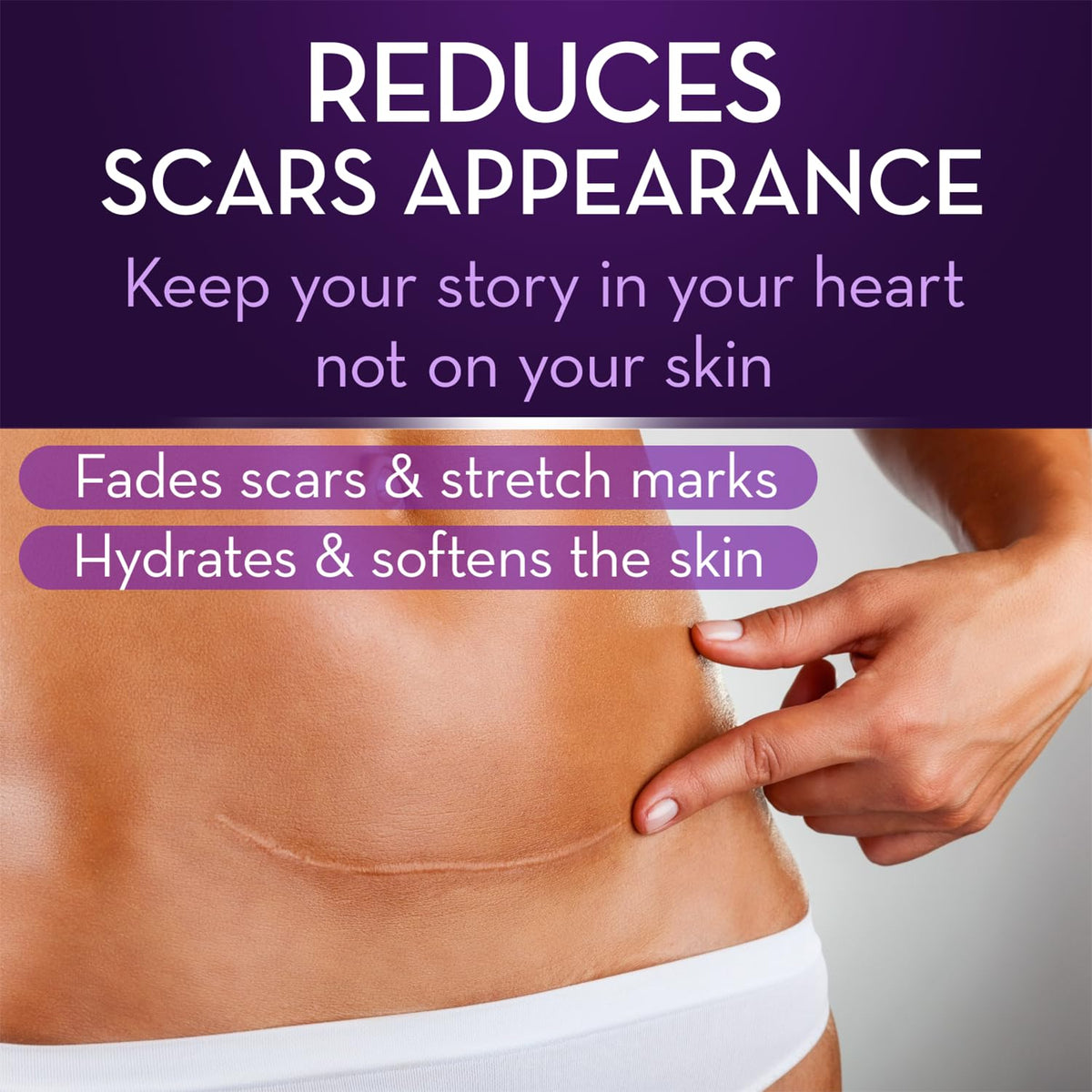 Cicatricure Scar Gel 1.0 oz