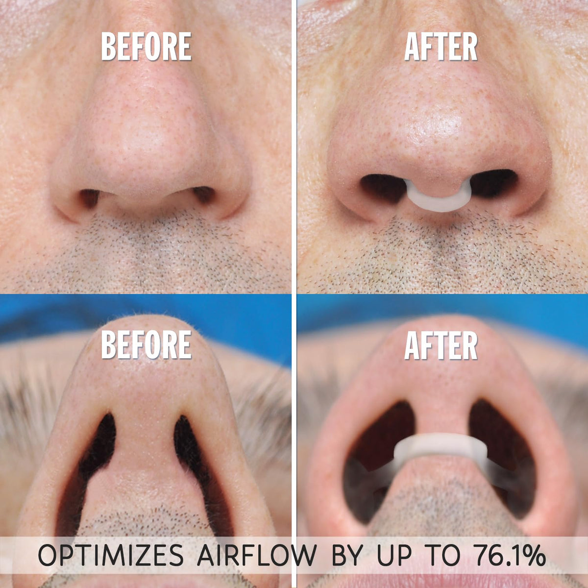 AIRMAX Nasal Dilator for Better Sleep - Natural, Comfortable, Anti Snoring Device, Snoring Solution for Maximum Airflow and Easier Breathing (Small – Clear)