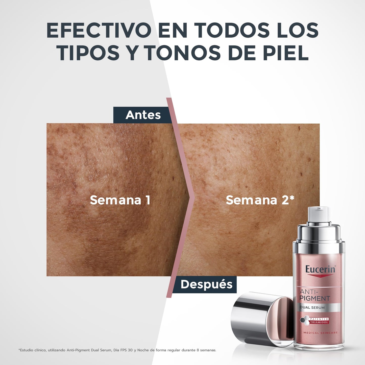 Eucerin Serum facial anti manchas Anti Pigment ,30ml