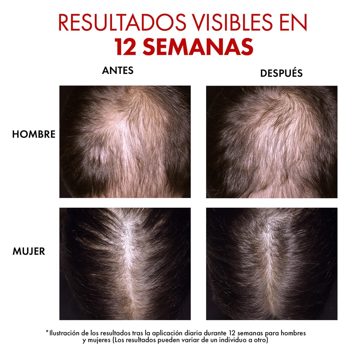Vichy Dercos R.E.G.EN Booster Sérum Capilar Anti-Caída Dermatológico 90ml | Regenerador Capilar, con Aminexil y Niacinamida, Reduce Caída, Estimula Crecimiento y Aporta Volumen