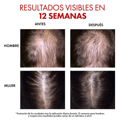 Vichy Dercos R.E.G.EN Booster Sérum Capilar Anti-Caída Dermatológico 90ml | Regenerador Capilar, con Aminexil y Niacinamida, Reduce Caída, Estimula Crecimiento y Aporta Volumen
