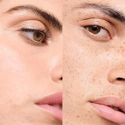 Vichy Normaderm Doble Corrección Anti-imperfecciones Dermatológico 50ml | Tratamiento Anti-Imperfecciones Hidratante que Corrige Brotes, Marcas, Reduce Poros y Regenera la Piel con Ácido Salicílico