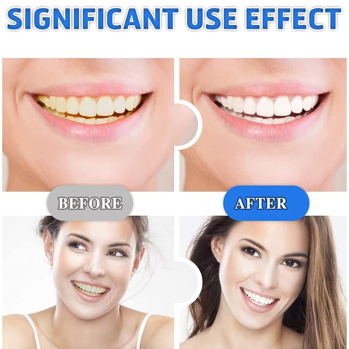 nvban 14Pcs Teeth Whitening Strips, 5D Teeth Whitening Strips, Professional Teeth Whitener and Teeth Whitening Kit, Safe Formula for Sensitive Teeth Teeth Whitening Kit