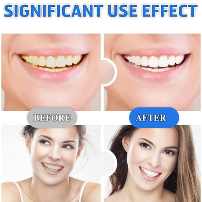 nvban 14Pcs Teeth Whitening Strips, 5D Teeth Whitening Strips, Professional Teeth Whitener and Teeth Whitening Kit, Safe Formula for Sensitive Teeth Teeth Whitening Kit