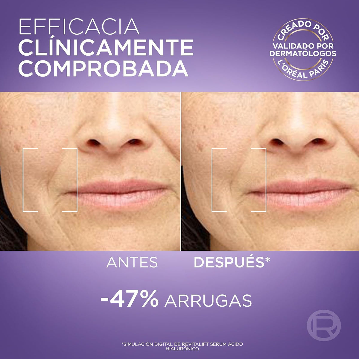 L'Oréal Paris Revitalift Ácido Hialurónico Serum, Hidrata Intensamente, Rellena Arrugas y Líneas de Expresión, Cuidado Facial Anti-edad, 30ml