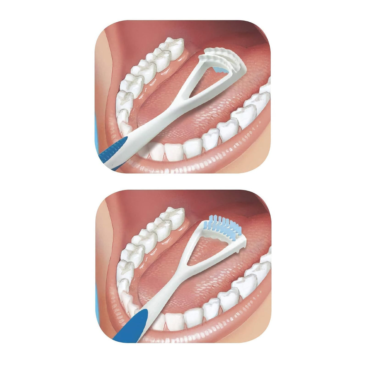 GUM Limpiador de lengua – cepillo para polvo de lengua de cerdas suaves de doble acción con raspador de lengua para una mejor higiene bucal, tratamiento de mal aliento (paquete de 3)