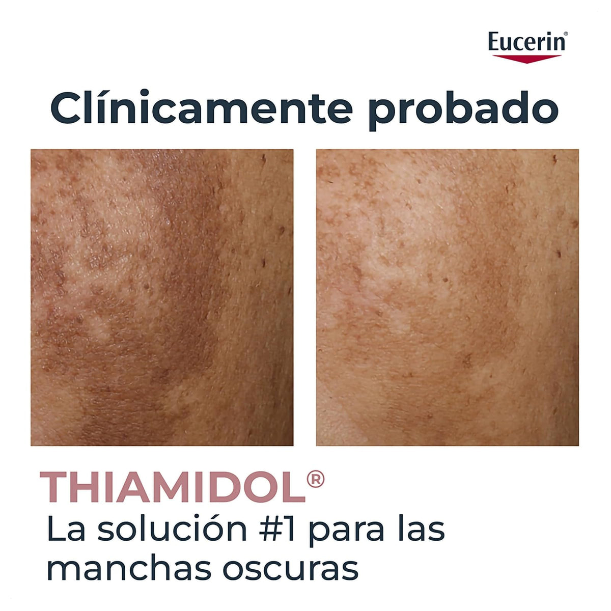 Eucerin Anti-Pigment Serum Corporal 75ml | Áreas sensibles, reduce manchas oscuras, unifica el tono, con Thiamidol, Ácido Hialurónico, Licochalcona A