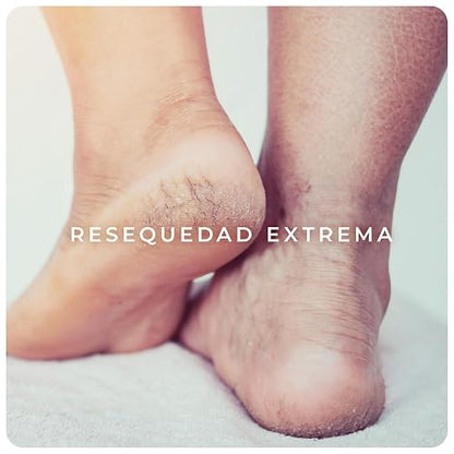 Derman DB Calm Emulsión Corporal │ Urea-D 10% + Ácido Hialurónico │ 400 mL | Hidratación profunda para piel muy seca, ayuda a recuperar elasticidad y fortalece la barrera cutánea