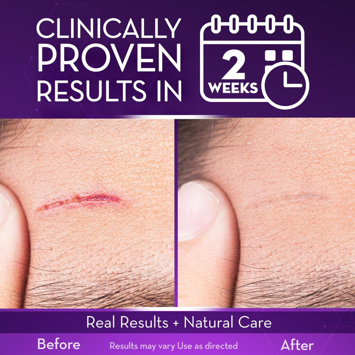 Cicatricure Scar Gel 1.0 oz