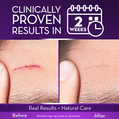 Cicatricure Scar Gel 1.0 oz