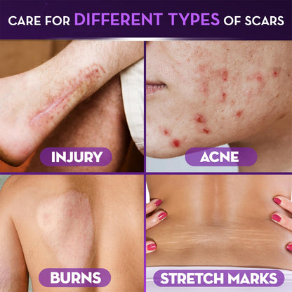 Cicatricure Scar Gel 1.0 oz