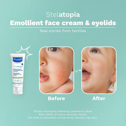 Mustela Stelatopia Emollient Face Cream, for Eczema-Prone Baby Skin, Fragrance-Free, with Natural Avocado Perseose and Ceramides, 1.35 Ounce
