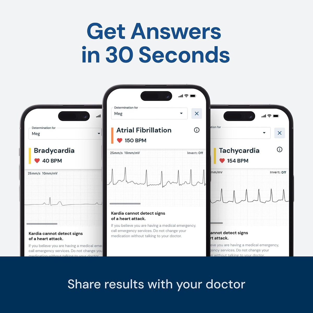 AliveCor® KardiaMobile Monitor ECG | Aprobado por FDA y CE| ECG inalámbrico personal |Funciona con smartphone | Detecta Fibrilación Auricular, Taquicardia y Bradicardia en 30 segundos