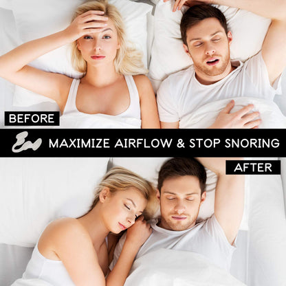 AIRMAX Nasal Dilator for Better Sleep - Natural, Comfortable, Anti Snoring Device, Snoring Solution for Maximum Airflow and Easier Breathing (Small – Clear)