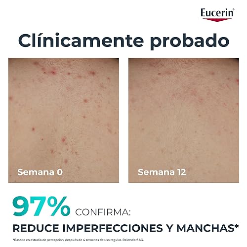 EUCERIN DermoPure Triple Effect Crema Corporal (200ml) Anti-Imperfecciones, Anti-Manchas, Anti-Brillo, Calma e hidrata, ideal para piel grasa o con imperfecciones