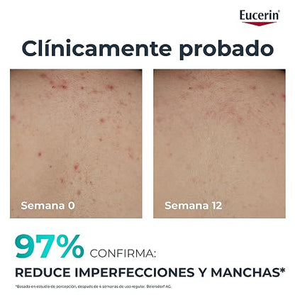 EUCERIN DermoPure Triple Effect Crema Corporal (200ml) Anti-Imperfecciones, Anti-Manchas, Anti-Brillo, Calma e hidrata, ideal para piel grasa o con imperfecciones