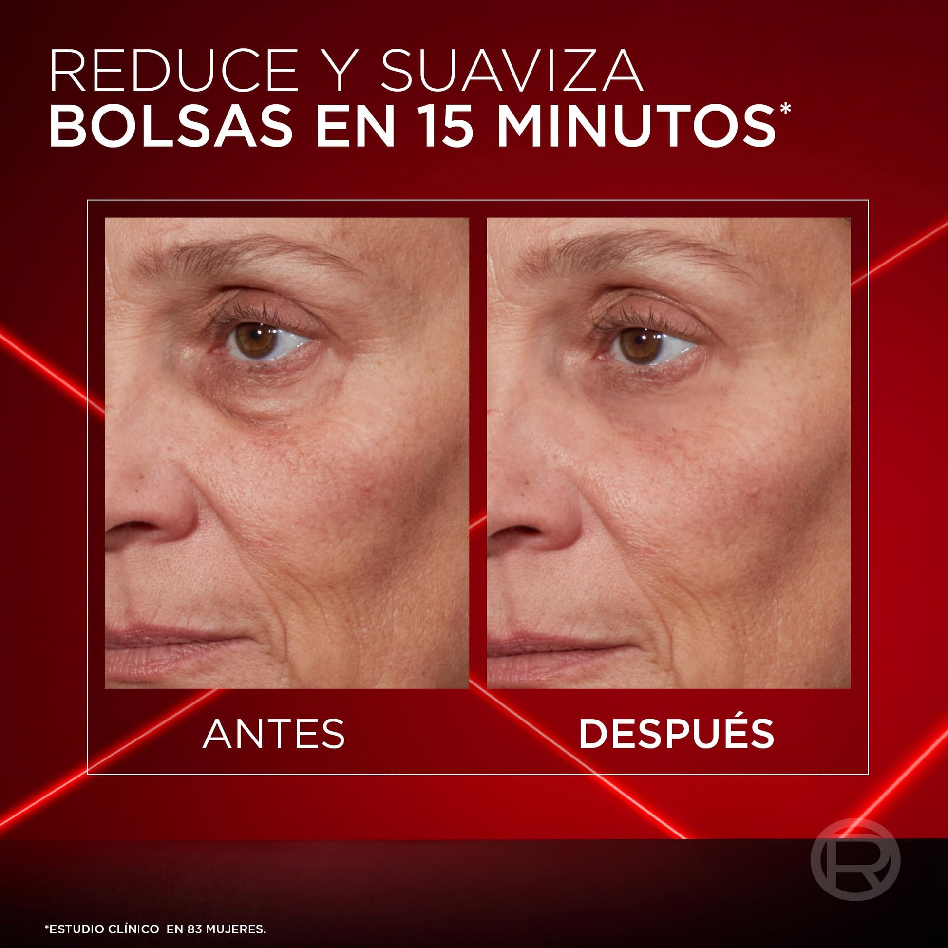L'Oreal Paris Revitalift Laser Crema para Ojos Borrador de Bolsas Instantaneo, Reduce y Suaviza Bolsas en 15 Minutos y Reafirma el Contorno de los Ojos, 15ml.