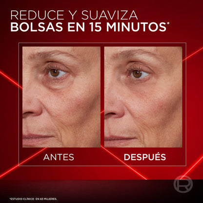 L'Oreal Paris Revitalift Laser Crema para Ojos Borrador de Bolsas Instantaneo, Reduce y Suaviza Bolsas en 15 Minutos y Reafirma el Contorno de los Ojos, 15ml.