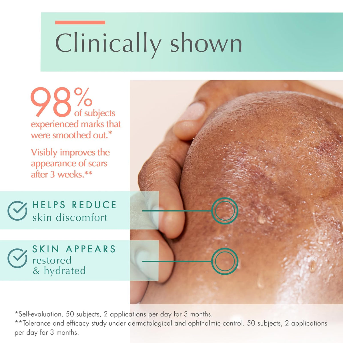 Eau Thermale Avene Cicalfate+ Scar Gel - Restorative Silicone Massage Gel for Superficial & Dermatological Scars - Postbiotic Skincare - Non-Comedogenic - 1 fl.oz.
