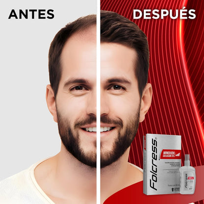Folcress Solución Minoxidil 5% - Tratamiento Anticaída para Hombres, Estimula el Crecimiento Capilar, Cuidado del Cabello - 60 ml
