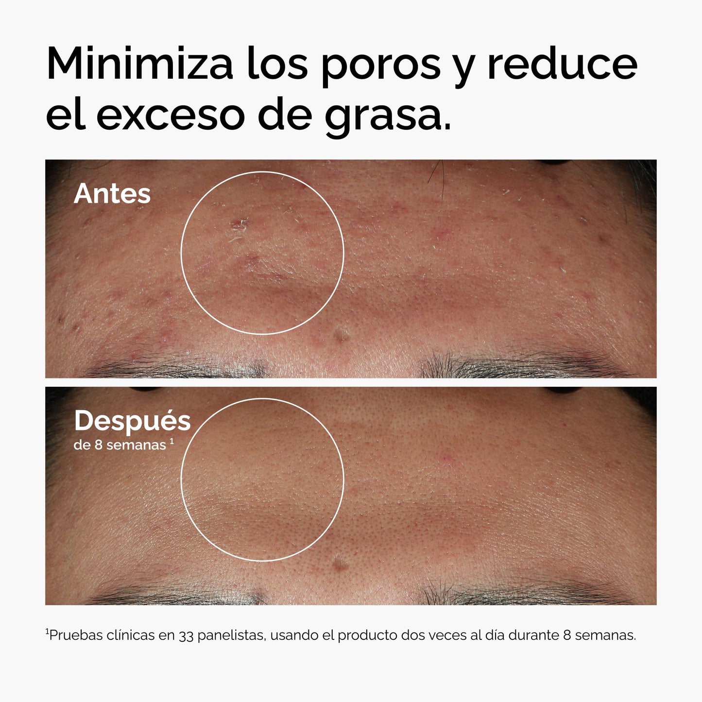 The Ordinary Niacinamide 10% + Zinc 1% 30ml