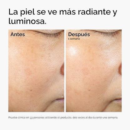 The Ordinary Rice Lipids + Ectoin Microemulsion, Suero hidratante para piel seca, hidratación calmante que ayuda con el enrojecimiento, 60 ml
