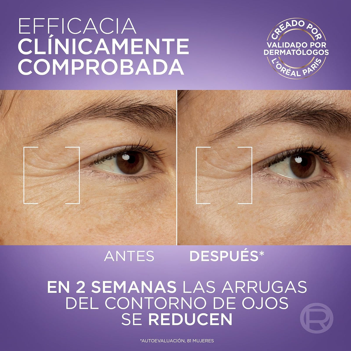 L'Oréal Paris Revitalift Filler Sérum de Ojos con Ácido Hialurónico + Cafeína, Rellena hasta 2.5% Líneas de Expresión y Corrige Ojeras, Aplicador Triple Perla, 15 ml